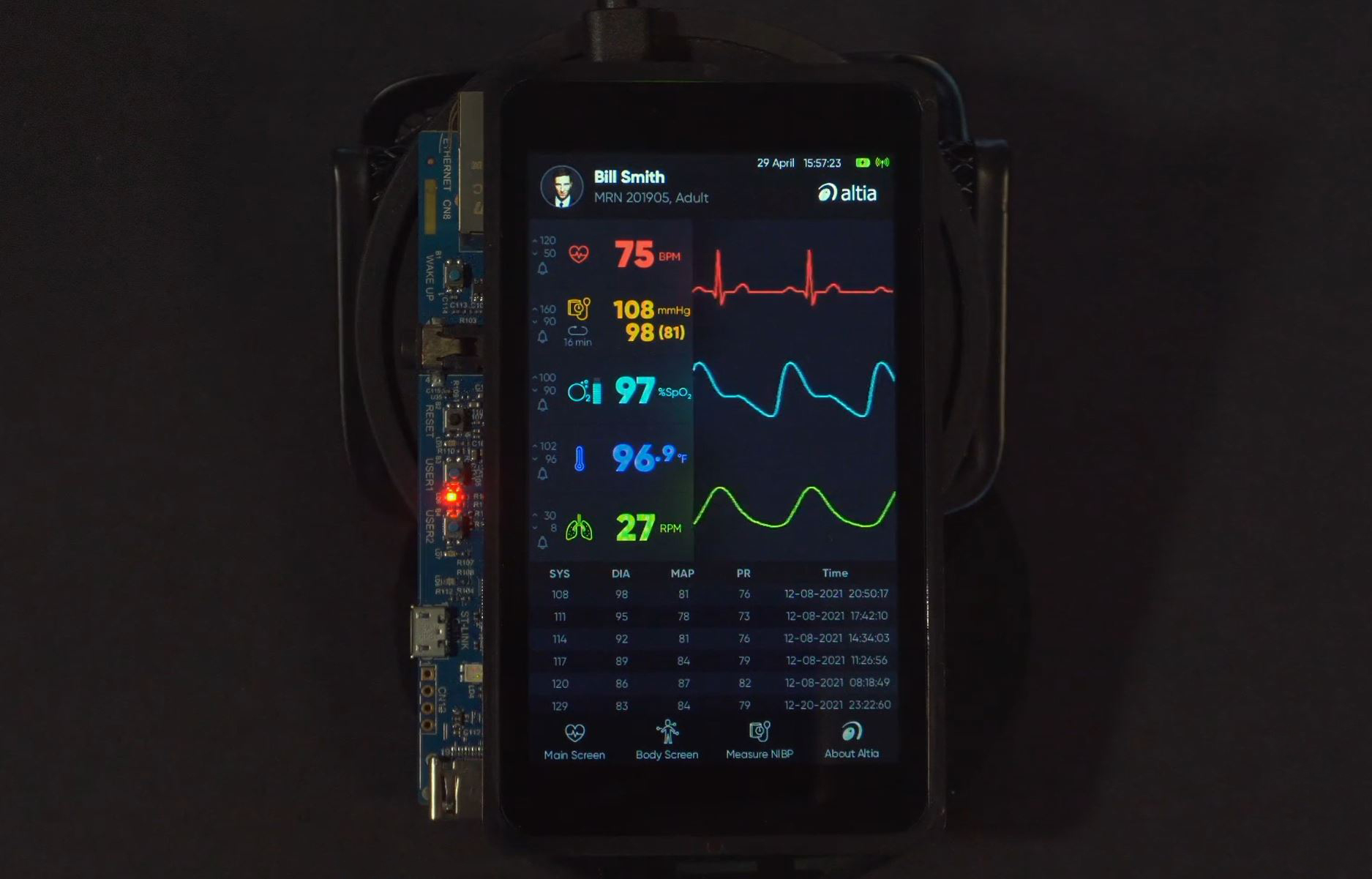 Health Monitor GUI on STM32MP1